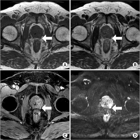 Marcus Lima, 59 anos <br>⭐⭐⭐⭐⭐